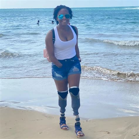 quad amputee woman|Torie Mugo Is Thriving After Sepsis as a Quadruple。